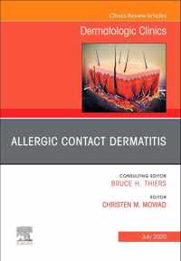 Allergic Contact Dermatitis