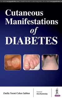 Cutaneous Manifestations of Diabetes