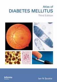 An Atlas of Diabetes Mellitus, Second Edition