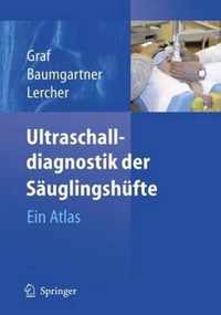 Ultraschalldiagnostik Der Sauglingshufte