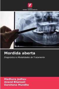 Mordida aberta