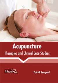 Acupuncture