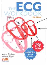 The ECG Workbook