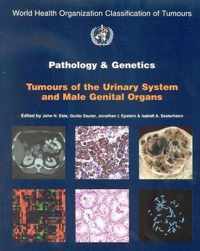 Pathology and Genetics of Tumours of the Urinary System and Male Genital Organs