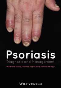 Psoriasis