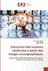 Extraction des tumeurs cerebrales a partir des images scanographiques