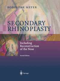 Secondary Rhinoplasty