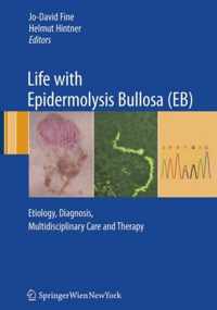 Life with Epidermolysis Bullosa (EB)