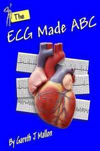 The ECG Made ABC