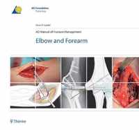 AO Manual of Fracture Management - Elbow & Forearm