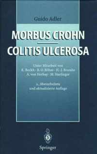 Morbus Crohn - Colitis Ulcerosa