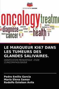 Le Marqueur Ki67 Dans Les Tumeurs Des Glandes Salivaires.