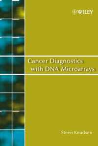 Cancer Diagnostics with DNA Microarrays