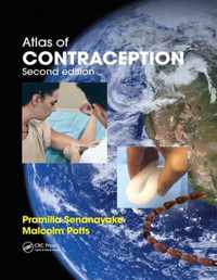 Atlas of Contraception