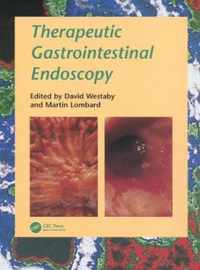 Therapeutic Gastrointestinal Endoscopy A problem-oriented approach