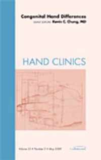 Congenital Hand Differences, An Issue of Hand Clinics