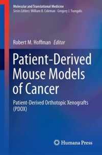 Patient Derived Mouse Models of Cancer