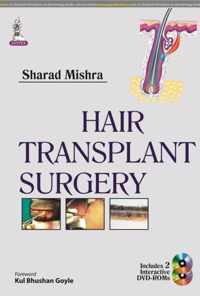 Hair Transplant Surgery