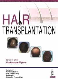 Hair Transplantation