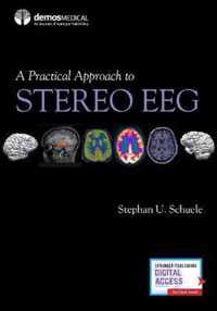 A Practical Approach to Stereo EEG