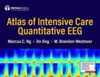 Atlas of Intensive Care Quantitative EEG