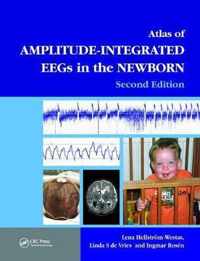 Atlas of Amplitude-Integrated EEGs in the Newborn