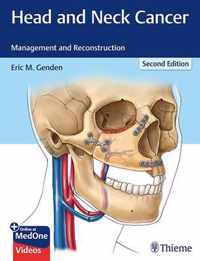 Head and Neck Cancer