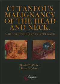 Cutaneous Malignancy of the Head and Neck