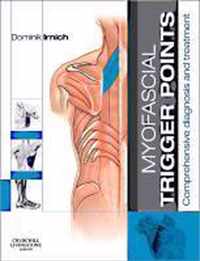 Myofascial Trigger Points