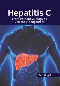 Hepatitis C