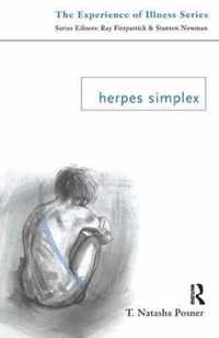 Herpes Simplex