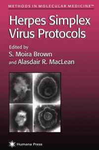 Herpes Simplex Virus Protocols