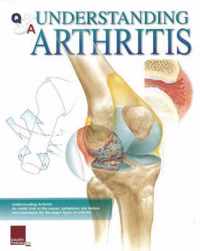 Understanding Arthritis Flip Chart