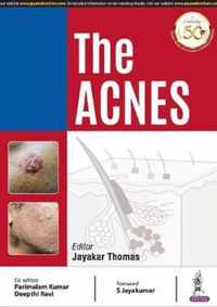 The Acnes