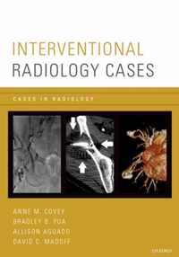 Interventional Radiology Cases