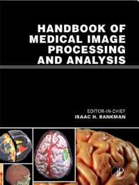 Handbook of Medical Image Processing and Analysis