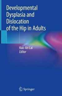 Developmental Dysplasia and Dislocation of the Hip in Adults