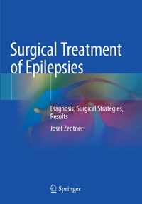 Surgical Treatment of Epilepsies