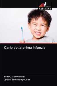 Carie della prima infanzia