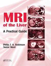 MRI of the Liver: A Practical Guide