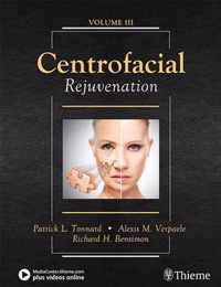 Centrofacial Rejuvenation