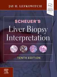 Scheuer's Liver Biopsy Interpretation