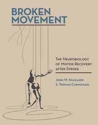 Broken Movement  The Neurobiology of Motor Recovery after Stroke