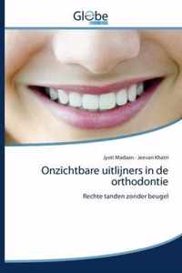 Onzichtbare uitlijners in de orthodontie