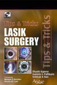 Lasik Surgery Tips and Tricks