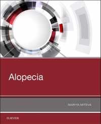 Alopecia