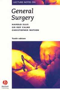 Lecture Notes on General Surgery, 10th Edition