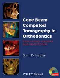 Cone Beam Computed Tomography in Orthodontics