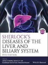 Sherlocks Diseases of the Liver and Biliary System