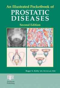 An Illustrated Pocketbook of Prostatic Disease